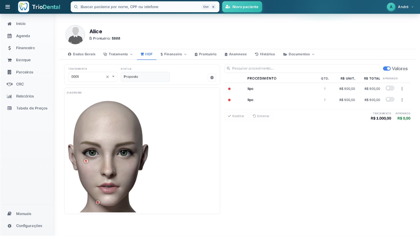 Harmonização Orofacial no TrioDental com diagrama facial e procedimentos